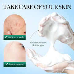 Sadoer Mousse Facial Cleanser Tea Tree 150g