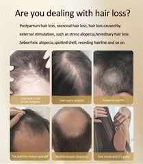 KINGYES Instant Hair Thickener Spray - 130ml