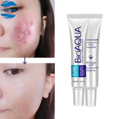 BIOAQUA- Acne Removal Pure Skin Cream - 30g