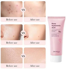 BIOAQUA Rose Hyaluronic Acid Moisturizing Cleanser – 100g