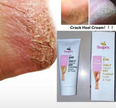 Soapex Crack Heel Cream