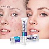 Bioaqua Acne Removal Cream Spot-Free Skin