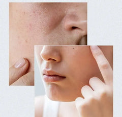 Anua Birch 70 Moisture Boosting Serum - 30ml (Made in Korea)