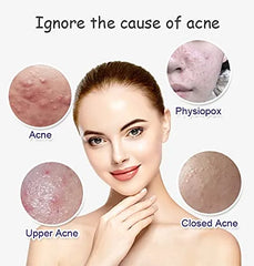 Aichun beauty Anti Acne Whitening Facial Serum - 30ml