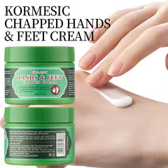 KORMESIC Anti-chapping Roughness Smoothing Chapped Hands and Feet Cream - 140g