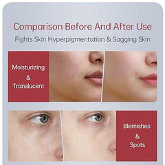 Zooson Freckle Cream Tube