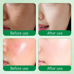 SADOER Milk Avocado Face Cream – Anti-Aging & Moisturizing with Goat Milk, Niacinamide & Vitamin E