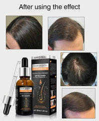 Hair Growth Essential Oil Biotin Cold-Pressed DHT Blocker - 30ml