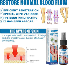 South Moon Vein Healing Varicose Veins Treatment Spray - 30ml
