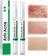SADOER Tea tree Anti-Acne Repair Pen - 2ml