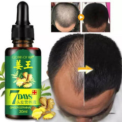 7 Days Hair Growth Germinal Serum - 30ml