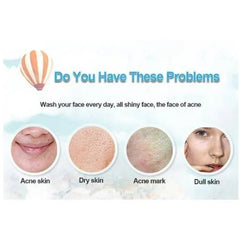 Bioaqua Acne Removal Cream Spot-Free Skin