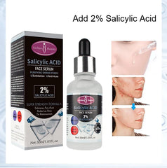 AICHUN BEAUTY Salicylic Acid Purifying Shrink Pores Exfoliation Anti-Acne Face Serum - 30ml