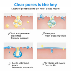 AICHUN BEAUTY Salicylic Acid Purifying Shrink Pores Exfoliation Anti-Acne Face Serum - 30ml