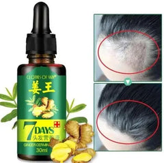 Aichun Beauty 7 Days Ginger Hair Growth Oil Serum For Damaged Hair - 30ml