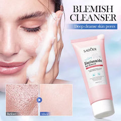 Sadoer Brightening Gentle Oil Control Refreshing Cleanser - 100g