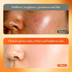 FAYANKOU Whitening Brightens Vitamin C Essence Cream - 50g