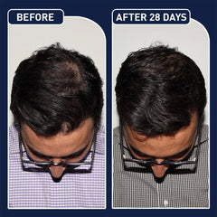 FEGPLUS Hair & Beard Growth Spary – 50ml