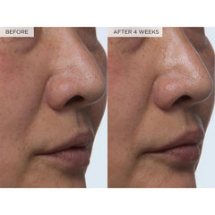 Glow Recipe Watermelon Glow PHA + BHA PoreTight Toner- 150ml