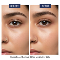 Jenpharm Dermive Oil Free Moisturizer Spf 20 - 100ml - Factory Leftover