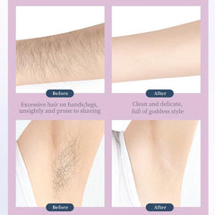 Kemei LCD Electric Tweezers Dry wet Use Portable Epilator