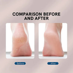 Flawless Electric Foot Callus Remover