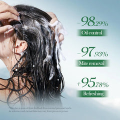 SADOER Natural Extract Shampoo Scalp Cleansing Oil-control Garlic Shampoo - 300ml