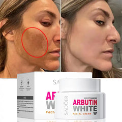 Sadoer Nicotinamide Arbutin White Facial Cream - 50g