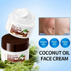 SADOER Nourishing Coconut Oil Moisturizing Face Cream - 50gm