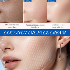 SADOER Nourishing Coconut Oil Moisturizing Face Cream - 50gm