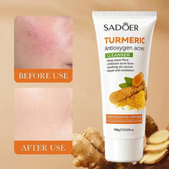 SADOER Turmeric AntiOxygen Acne Facial Cleanser - 100g
