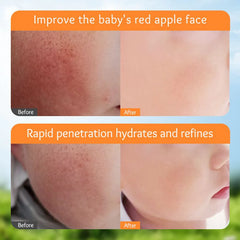 Sadoer Calendula Amino Acid Formula Baby Moist Cream – 50 g