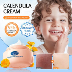 Sadoer Calendula Amino Acid Formula Baby Moist Cream – 50 g