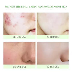 BIOAQUA Natural Aloe Vera Moisturizing Gel Mask - 170gm