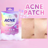 Aichun Beauty Acne Get Out! Patches - Each