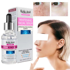 Kojic Acid Whitening Facial Serum - 30ml