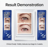 Kormesic Eye Bags Removal Serum - 10g