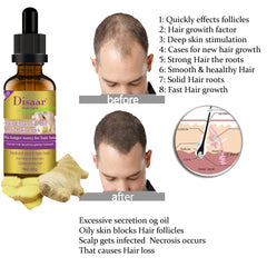 Disaar Anti-Hair Loss Ginger Oil – 30g