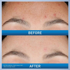 CeraVe Resurfacing Retinol Serum – 30ml