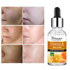 DISAAR Vitamin C Whitening Face Serum - 30ml