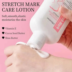 KORMESIC Stretch Mark Care Lotion – 200ml