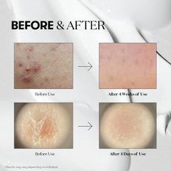 Reedle Shot 100 Esseence Revitalizing & Youth - 50ml