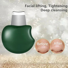 Portable Manual Blackhead Remover Tool for Facial Skincare, Pore Cleaning and Tightening