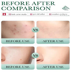 Bioaqua Salicylic Acid Cleanser