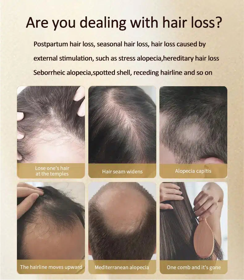 KINGYES Instant Hair Thickener Spray - 130ml