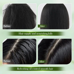 Sadoer Natural Hair Care Anti-Dandruff Shampoo - 520ml