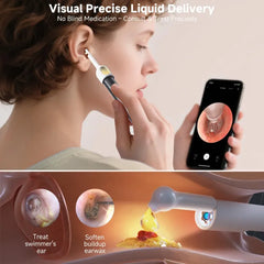 Smart Visual Ear Wax Cleaning Kit – Wireless HD Camera Ear Cleaner