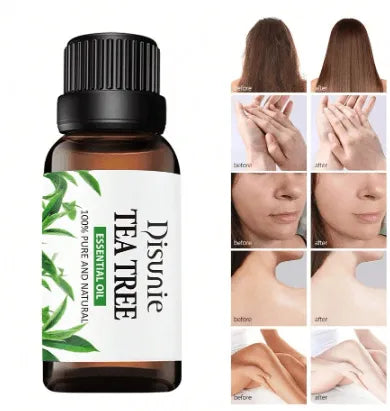 Disunie Tea Tree Essential Oil 30ml