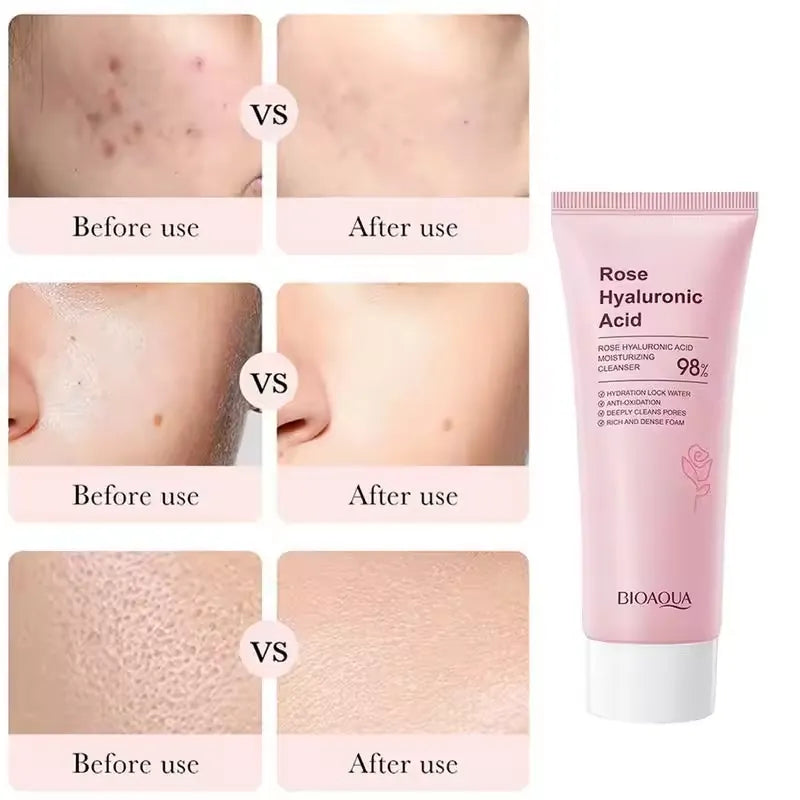 BIOAQUA Rose Hyaluronic Acid Moisturizing Cleanser – 100g