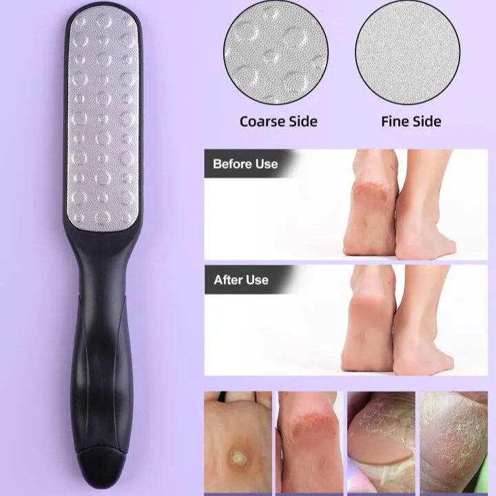 Sweet Beauty Plastic Handle Foot Callus Remover
